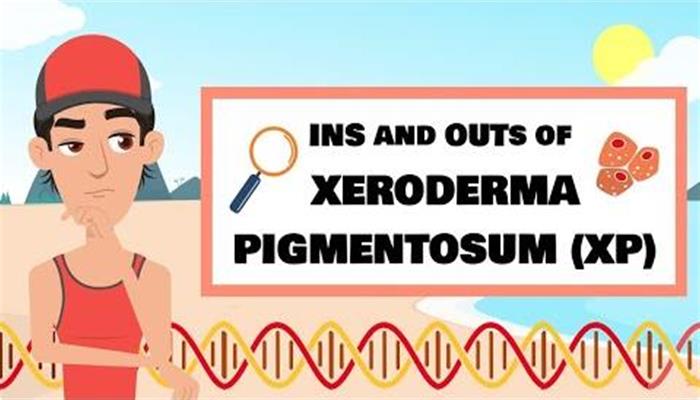 The ins and outs of xeroderma pigmentosum (xp)