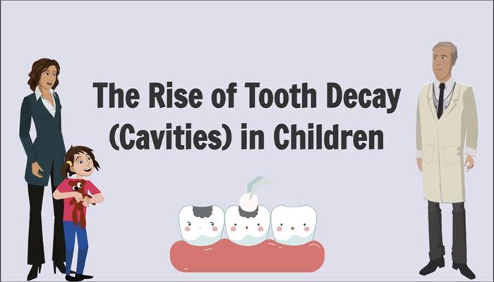 The Rise of Tooth Decay in Children