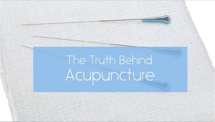 The truth behind acupuncture