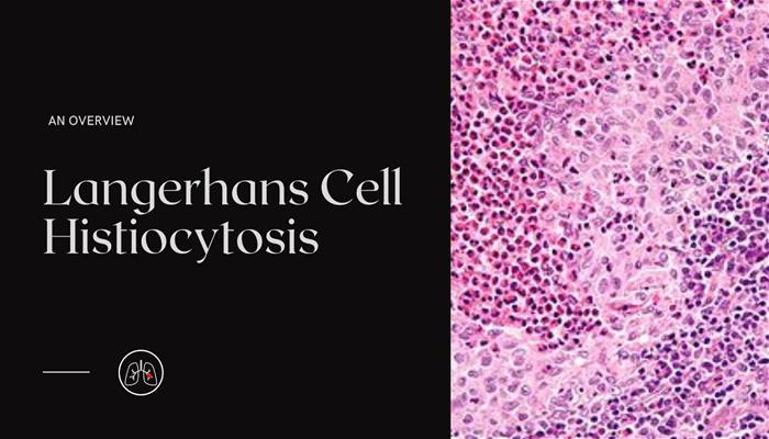 langerhans cells