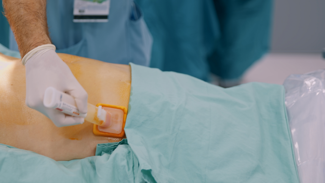 A knee being disinfected and prepared for surgery.