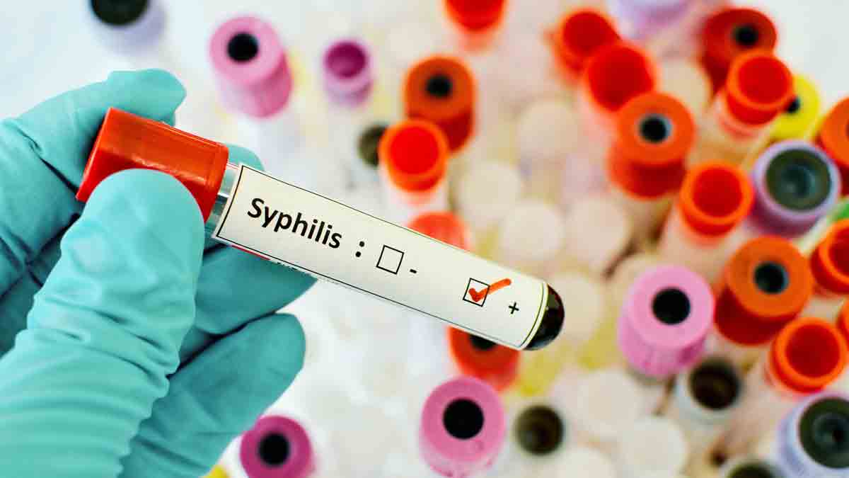 A vial with a red cap and a label identifying the sample is positive for syphilis.